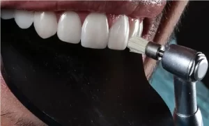 پالیش کامپوزیت