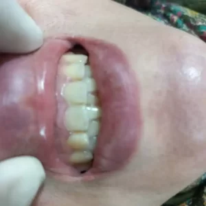کامپوزیت 3