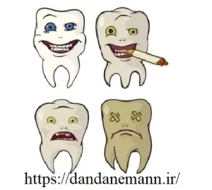 مضرات سیگار برای دندان